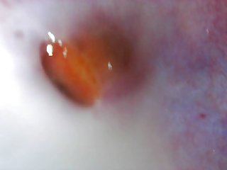 His Red Hot Angry Penis Trying To Home In On The Source Of Its Need